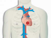 Scientific Papers on Ischemic Heart Disease